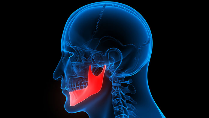Disfunção da articulação temporomandibular