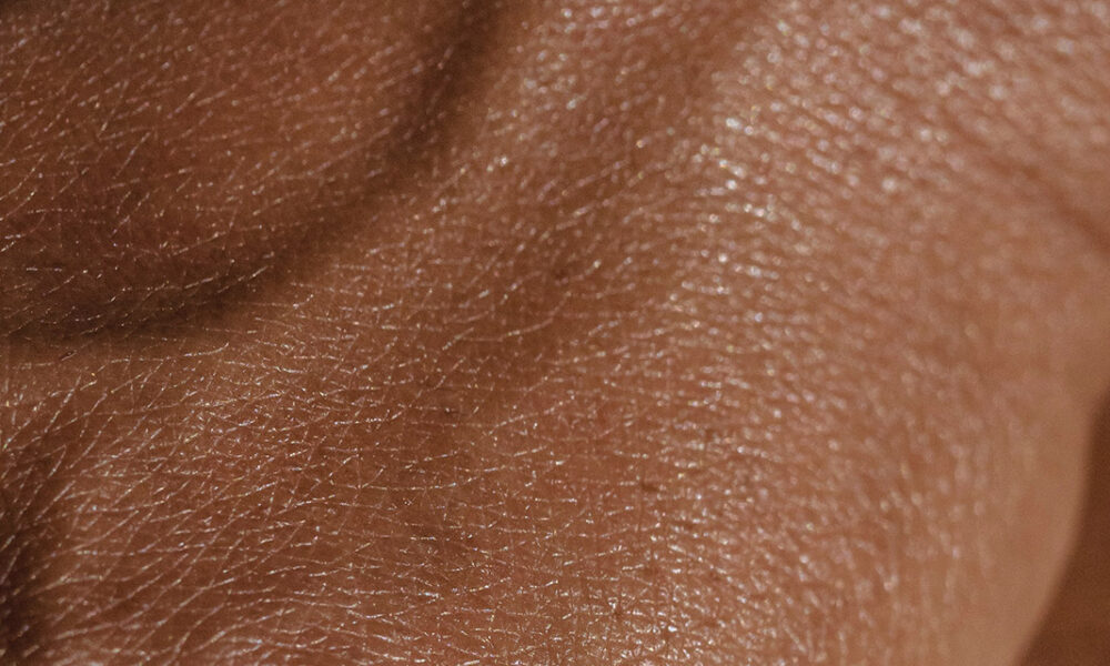 10 dicas essenciais para cuidar bem da pele durante o verão
