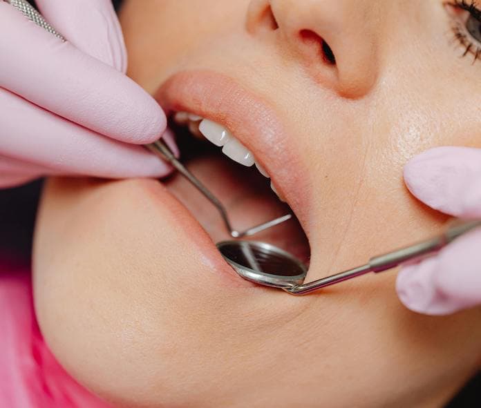 Doença periodontal pode estar ligada a problemas cardíacos, diabetes e Alzheimer